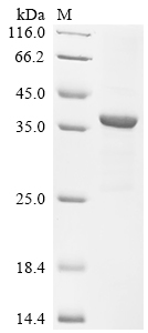 Recombinant Human respiratory syncytial virus A Major surface glycoprotein G (G), partial, Biotinylated