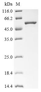 Recombinant Human Melanoma-associated antigen B1 (MAGEB1)
