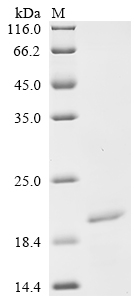 Recombinant Mesocricetus auratus protein-tyrosine-phosphatase (Ptprc), partial