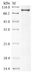 Recombinant Human Protein kinase C eta type (PRKCH)