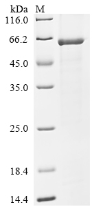 Recombinant Rat Serine/threonine-protein kinase Chk1 (Chek1)