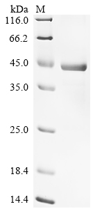 Recombinant Human Carbohydrate deacetylase (YDJC)