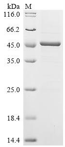 Recombinant Human Histone deacetylase 11 (HDAC11)