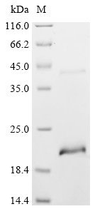 Recombinant Mesocricetus auratus tumor necrosis factor receptor superfamily member 9 isoform X1 (Tnfrsf9), partial