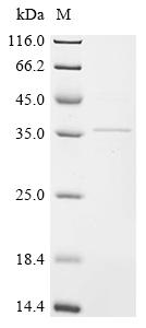 Recombinant Rat Troponin T, cardiac muscle (Tnnt2)