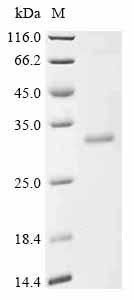 Recombinant Human Dipeptidyl peptidase 9 (DPP9), partial