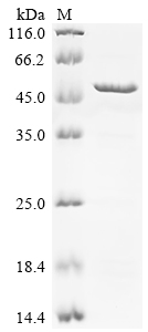 Recombinant Human Melanoma-associated antigen 8 (MAGEA8)