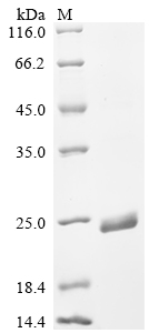 Recombinant Monkeypox virus Envelope protein A28 homolog (A30L), partial