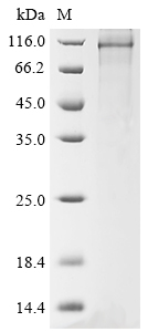 Recombinant Human Peroxisome proliferator-activated receptor gamma coactivator 1-alpha (PPARGC1A)