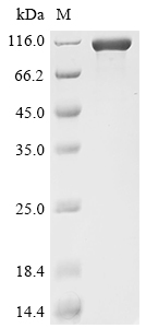 Recombinant Mouse Cadherin-17 (Cdh17), partial