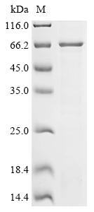 Recombinant Human Galactocerebrosidase (GALC)