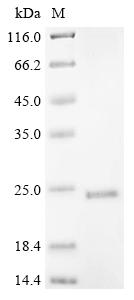 Recombinant Mouse ER lumen protein retaining receptor 2 (Kdelr2)