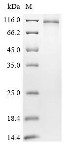 Recombinant Acinetobacter baumannii Efflux pump membrane transporter (HMPREF0010_00594)