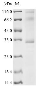 Recombinant Human Taste receptor type 2 member 13 (TAS2R13)