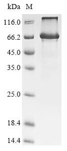 Recombinant Human Cysteine-rich secretory protein LCCL domain-containing 1 (CRISPLD1) (G371D)