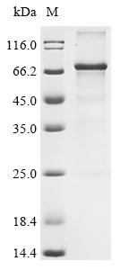 Recombinant Human Cysteine-rich secretory protein LCCL domain-containing 1 (CRISPLD1) (R431H)