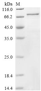 Recombinant Human Cysteine-rich secretory protein LCCL domain-containing 1 (CRISPLD1)
