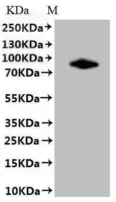 Recombinant Coxiella burnetii Hypothetical membrane spanning protein (CBU_1863) (L589A,L590A)