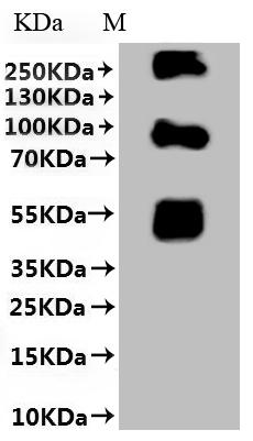 Recombinant Coxiella burnetii Hypothetical membrane spanning protein (CBU_1863) (L589A,L590A)
