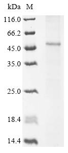 Recombinant Human Vasopressin V1b receptor (AVPR1B)