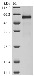 Recombinant Human Tumor necrosis factor receptor superfamily member 11A (TNFRSF11A), partial