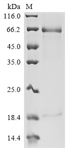 Recombinant Human Proprotein convertase subtilisin/kexin type 9 (PCSK9) (R194A), partial