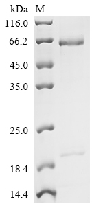 Recombinant Human Proprotein convertase subtilisin/kexin type 9 (PCSK9) (D374Y), partial