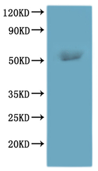 Recombinant Human Histamine H3 receptor (HRH3), Fluorescent-VLPs