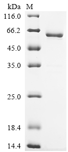 Recombinant Mouse Insulin-like growth factor-binding protein 7 (Igfbp7)