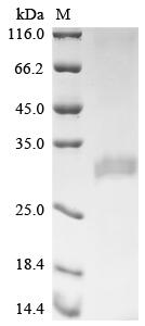 Recombinant Human Translationally-controlled tumor proteinv (SMPD1)