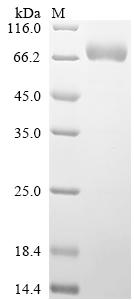 Recombinant Human Sphingomyelin phosphodiesterase (SMPD1)