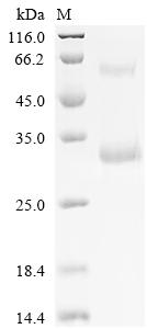 Recombinant Human Gamma-interferon-inducible lysosomal thiol reductase (IFI30), partial