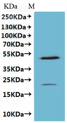 Recombinant Human Claudin-18.2 (CLDN18.2)-VLPs, Fluorescent (Active)