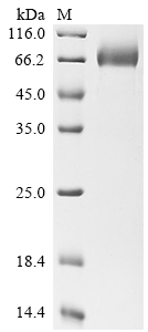 Recombinant Human Mesothelin (MSLN), partial, Biotinylated