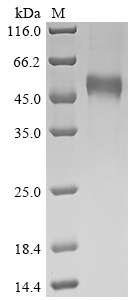 Recombinant Human Interferon gamma (IFNG)
