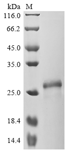 Recombinant Human Somatotropin (GH1), Biotinylated