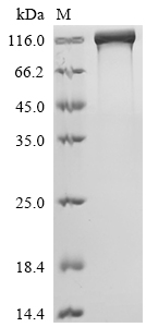 Recombinant Human Epidermal growth factor receptor (EGFR), partial, Biotinylated