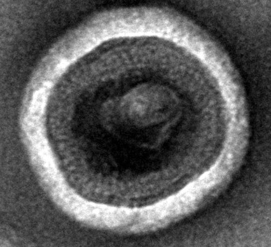 Recombinant Human Claudin-6 (CLDN6)-VLPs, Fluorescent (Active)