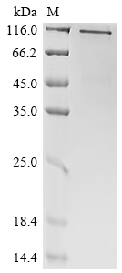 Recombinant Human CD70 antigen (CD70), partial