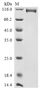 Recombinant Human B-cell receptor CD22 (CD22), partial, Biotinylated