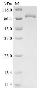 Recombinant Human Prostatic acid phosphatase (ACP3), partial