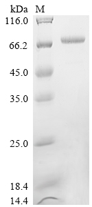 Recombinant Pseudomonas aeruginosa Elastase (lasB)