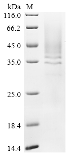 Recombinant Human Cathepsin B (CTSB)