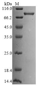 Recombinant HumanKelch-like ECH-associated protein 1 (KEAP1)