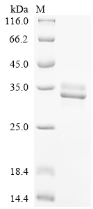 Recombinant Chicken Neurofibromin (NF1), partial