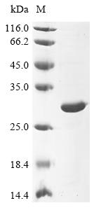 Recombinant Human cytomegalovirus Major capsid protein (MCP), partial