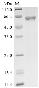 Recombinant Human Acetyl-CoA carboxylase 1 (ACACA), partial