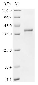 Recombinant Human NPC1-like intracellular cholesterol transporter 1 (NPC1L1), partial