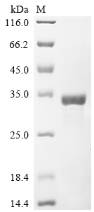 Recombinant Human CCR4-NOT transcription complex subunit 7 (CNOT7)