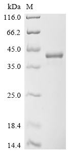 Recombinant Human Transcription factor SOX-2 (SOX2)